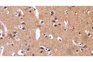 Immunohistochemistry of paraffin-embedded Human brain tissue using SELPLG Polyclonal Antibody at dilution 1:50 (SELPLG Antikörper)