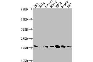 Western Blot Positive WB detected in: 293 whole cell lysate, Hela whole cell lysate, Jurkat whole cell lysate, MCF-7 whole cell lysate, K562 whole cell lysate, HepG2 whole cell lysate, U87 whole cell lysate All lanes: SOD1 antibody at 1:1500 Secondary Goat polyclonal to rabbit IgG at 1/50000 dilution Predicted band size: 16 kDa Observed band size: 18 kDa (Rekombinanter SOD1 Antikörper)