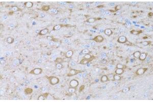 Immunohistochemistry of paraffin-embedded Mouse brain using MYH10 Polyclonal Antibody at dilution of 1:100 (40x lens). (MYH10 Antikörper)