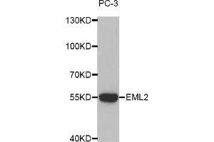 Western blot analysis of extracts of PC-3 cells, using EML2 antibody (ABIN5972622).
