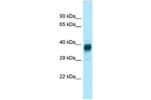 WB Suggested Anti-Olfr329-ps Antibody Titration: 1. (OLFR329-PS Antikörper  (Middle Region))