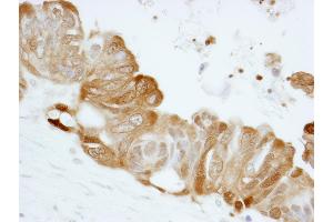 Immunohistochemistry (IHC) image for anti-Stratifin (SFN) (AA 198-248) antibody (ABIN7448925) (14-3-3 sigma/SFN Antikörper  (AA 198-248))