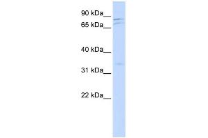 WB Suggested Anti-NEK11 Antibody Titration:  0. (NEK11 Antikörper  (Middle Region))