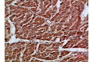 Immunohistochemical analysis of paraffin-embedded human-heart, antibody was diluted at 1:200 (ARTN Antikörper  (AA 101-150))