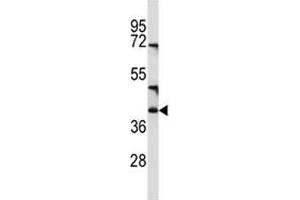 CD1c antibody western blot analysis in NCI-H460 lysate (CD1c Antikörper  (AA 226-253))