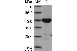 Western Blotting (WB) image for C-Src tyrosine Kinase (CSK) protein (ABIN7320121) (CSK Protein)