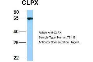 Host: Rabbit Target Name: WT1 Sample Type: 721_B Antibody Dilution: 1. (CLPX Antikörper  (C-Term))