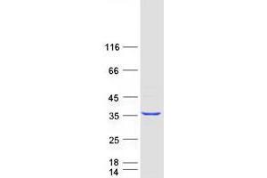 Validation with Western Blot (GPN2 Protein (Myc-DYKDDDDK Tag))