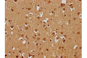 IHC image of ABIN7169769 diluted at 1:400 and staining in paraffin-embedded human brain tissue performed on a Leica BondTM system. (SKOR1 Antikörper  (AA 744-965))