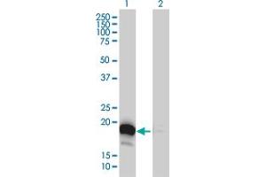 Western Blot analysis of DUT expression in transfected 293T cell line by DUT monoclonal antibody (M01), clone 1C9.