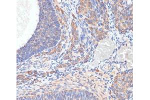 Immunohistochemistry of paraffin-embedded Rat ovary using TES Polyclonal Antibody at dilution of 1:100 (40x lens).