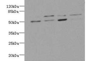 Western blot All lanes: LDB3 antibody at 3. (LIM Domain Binding 3 Protein Antikörper  (AA 1-283))