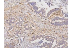IHC analysis of RAB3GAP2 using anti-RAB3GAP2 antibody (ABIN6719633). (RAB3GAP2 Antikörper  (AA 1-115))