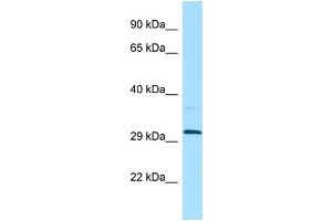 WB Suggested Anti-LILRA5 Antibody Titration: 1. (LILRA5 Antikörper  (N-Term))
