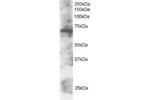 Image no. 1 for anti-SWAP Switching B-Cell Complex 70kDa Subunit (SWAP70) (C-Term) antibody (ABIN374192) (SWAP70 Antikörper  (C-Term))