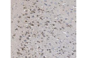 IHC analysis of PNPT1 using anti-PNPT1 antibody (ABIN7599172). (PNPT1 Antikörper  (AA 1-257))