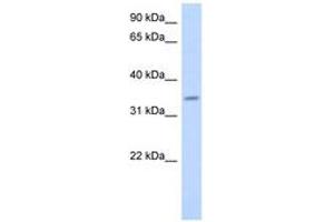 Image no. 1 for anti-Progestin and AdipoQ Receptor Family Member VI (PAQR6) (AA 107-156) antibody (ABIN6743533) (PAQR6 Antikörper  (AA 107-156))