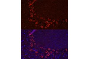 Immunofluorescence analysis of mouse brain using SLC1 antibody (ABIN6131630, ABIN6147868, ABIN6147869 and ABIN6219899) at dilution of 1:100. (SLC1A1 Antikörper  (AA 430-524))