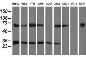 Western blot analysis of extracts (35 µg) from 9 different cell lines by using anti-PYCR2 monoclonal antibody. (PYCR2 Antikörper)