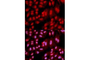 Immunofluorescence analysis of U2OS cell using PPP2R2A antibody. (PPP2R2A Antikörper  (AA 1-447))