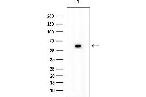 anti-Signal Peptide Peptidase-Like 2B (SPPL2B) antibody
