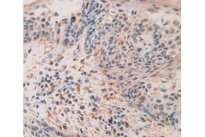 Figure. (QSOX1 Antikörper  (AA 394-519))