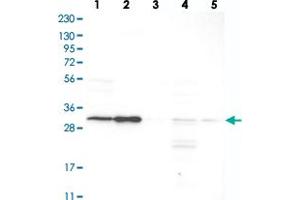 Western blot analysis of Lane 1: RT-4, Lane 2: U-251 MG, Lane 3: Human Plasma, Lane 4: Liver, Lane 5: Tonsil with SLC25A22 polyclonal antibody  at 1:250-1:500 dilution. (SLC25A22 Antikörper)
