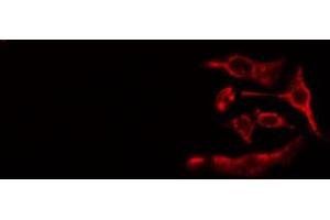 ABIN6267522 staining Hela cells by IF/ICC. (ZAP70 Antikörper  (pTyr493))