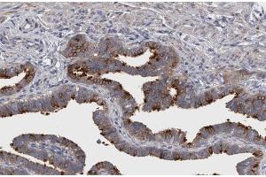 ABIN6267299 at 1/200 staining human Fallopian tube sections by IHC-P. (Integrin beta 3 Antikörper  (pTyr773))