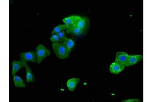 Immunofluorescent analysis of HepG2 cells using ABIN7170709 at a dilution of 1:100 and Alexa Fluor 488-congugated AffiniPure Goat Anti-Rabbit IgG(H+L) (STARD9 Antikörper  (AA 1960-2180))