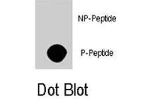 Dot blot analysis of AKT3 (phospho S472) polyclonal antibody  on nitrocellulose membrane. (AKT3 Antikörper  (pSer472))