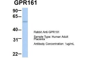 Host:  Rabbit  Target Name:  GPR161  Sample Type:  Human Adult Placenta  Antibody Dilution:  1. (GPR161 Antikörper  (Middle Region))