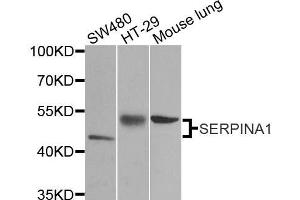 Western blot analysis of extracts of various cell lines, using SERPINA1 antibody. (SERPINA1 Antikörper  (AA 25-315))