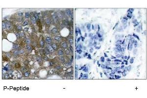 Image no. 1 for anti-Heat Shock 27kDa Protein 1 (HSPB1) (pSer15) antibody (ABIN196894) (HSP27 Antikörper  (pSer15))