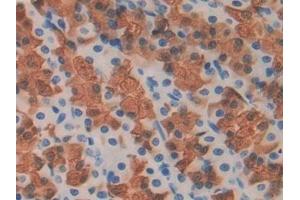 Immunohistochemistry (IHC) image for anti-Fibulin 1 (FBLN1) (AA 127-243) antibody (ABIN7440179)