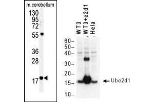 Image no. 1 for anti-Ubiquitin-Conjugating Enzyme E2D 1 (UBE2D1) (C-Term) antibody (ABIN357485)