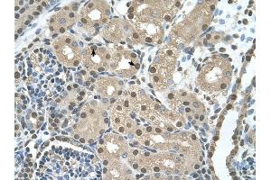 SBDS antibody was used for immunohistochemistry at a concentration of 4-8 ug/ml to stain Epithelial cells of renal tubule (arrows) in Human Kidney.