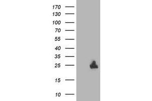 Western Blotting (WB) image for anti-Deoxythymidylate Kinase (Thymidylate Kinase) (DTYMK) antibody (ABIN1497918) (DTYMK Antikörper)
