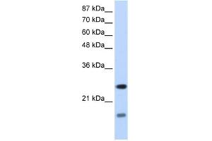 WB Suggested Anti-SRAntibody Titration:  1. (SRP14 Antikörper  (N-Term))