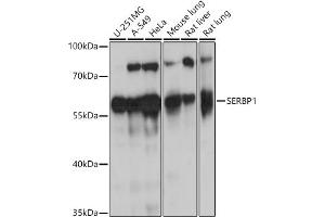 Western blot analysis of extracts of various cell lines, using SERBP1 antibody (ABIN7270252) at 1:1000 dilution. (SERBP1 Antikörper  (AA 1-114))