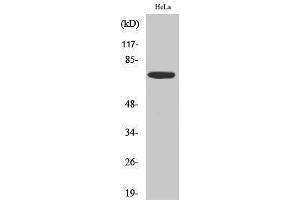 Western Blotting (WB) image for anti-Eukaryotic Translation Initiation Factor 2-alpha Kinase 2 (EIF2AK2) (Thr392) antibody (ABIN3176940) (EIF2AK2 Antikörper  (Thr392))