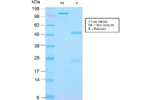 SDS-PAGE Analysis Purified S100A8/A9 Complex Recombinant Rabbit Monoclonal (MAC3157R). (Rekombinanter S100A8 Antikörper)