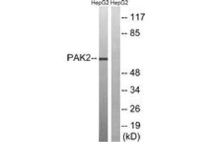 Western blot analysis of extracts from HepG2 cells, treated with serum 20% 15', using PAK2 (Ab-192) Antibody. (PAK2 Antikörper  (AA 158-207))