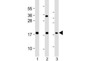 Western blot testing of human 1) HeLa, 2) THP1 and 3) RPMI 8226 cell lysate with GPX7 antibody at 1:2000. (Glutathione Peroxidase 7 Antikörper  (AA 73-107))