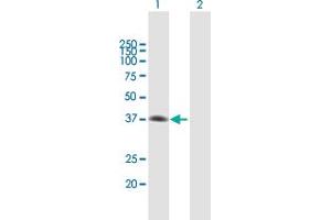 Western Blot analysis of MAD2L1BP expression in transfected 293T cell line by MAD2L1BP MaxPab polyclonal antibody. (MAD2L1BP Antikörper  (AA 1-306))