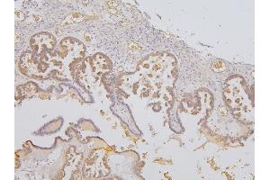 IHC analysis of SLC12A5 using anti-SLC12A5 antibody (ABIN6719415).