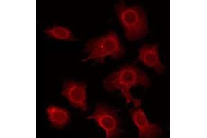 ABIN6275855 staining HeLa by IF/ICC. (STK33 Antikörper  (N-Term))