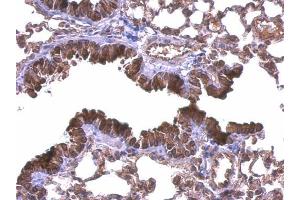 Immunohistochemistry (IHC) image for anti-Diaphanous Homolog 1 (DIAPH1) (C-Term) antibody (ABIN2855273)