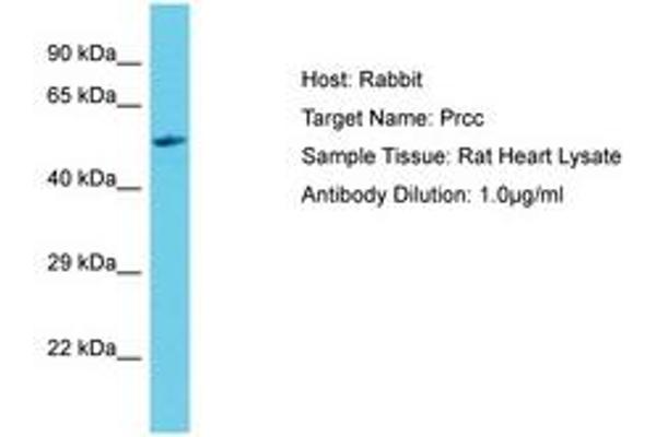 PRCC Antikörper  (C-Term)