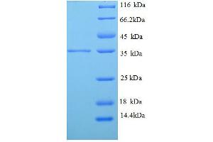 SDS-PAGE (SDS) image for Tropomyosin-2 (TPM2) (AA 14-284), (partial) protein (His tag) (ABIN1095783)